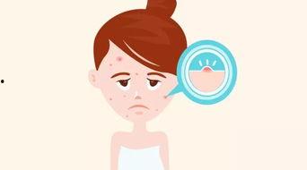 清理痘痘视频,跟随视频轻松掌握清洁祛痘秘诀