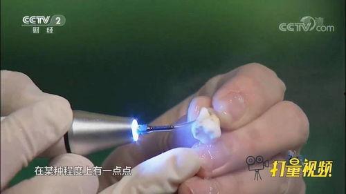 洗牙过程视频,轻松了解牙齿清洁新体验