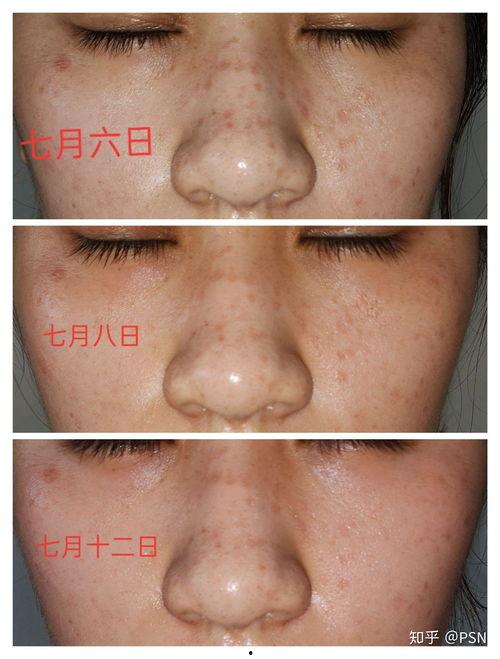 点斑视频,揭秘视觉艺术的新篇章