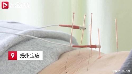 针灸学习视频,跟随视频学习针灸技巧与原理