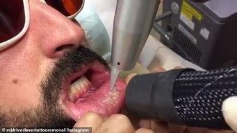 纹嘴唇视频,跟随视频领略唇部艺术之美