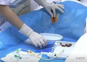 男性导尿视频操作,男性导尿操作步骤详解